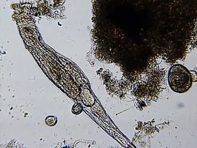 Skratki z oczyszczalni ścieków: Kto je odbiera i co się z nimi dzieje?